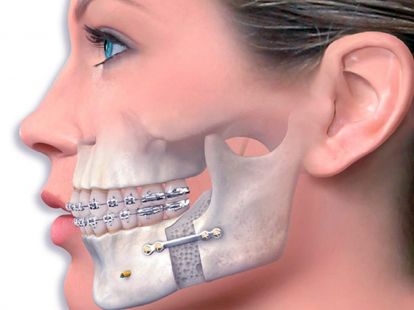 Maxillofacial surgery (ID:7666)