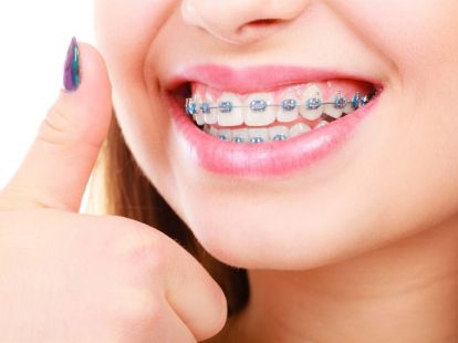 Orthodontics (ID:7670)