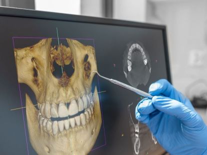 Radiology of the oral cavity, dentistry and maxillofacial surgery (ID:7689)
