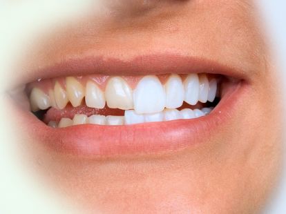 Dentistry (ID:9708)