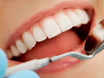 Косметические стоматологические услуги в Дубае - Ref: 1080 фото 2