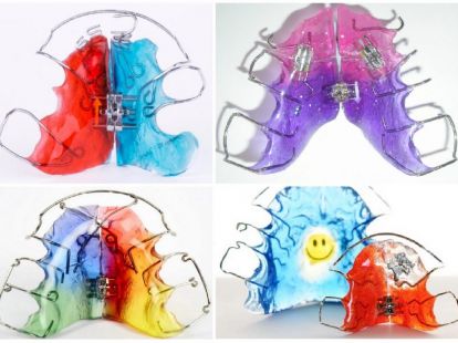 Детская ортодонтия в Дубае - Ref: 1081 фото 2