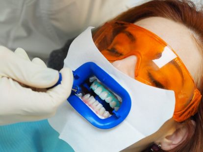 Лазерное отбеливание зубов в Дубае - Ref: 1082 фото 2