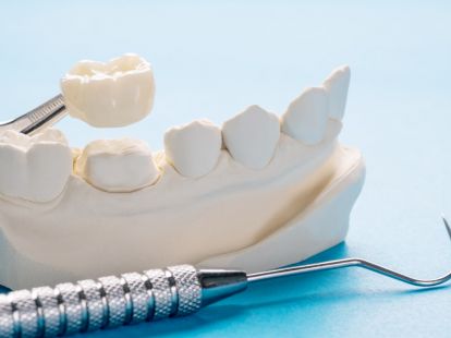 Dental crowns in Barcelona (ID:5680)