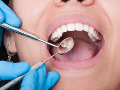 Pulpitis treatment (ID:5684)