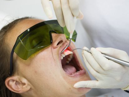 Treatment of periodontitis in Barcelona (ID:5760)